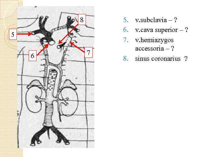 8 5 6 7 5. v. subclavia – ? 6. v. cava superior –