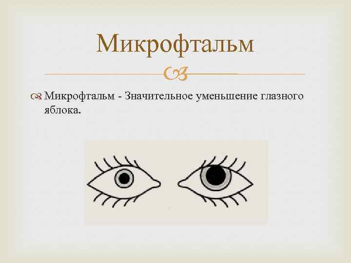 Микрофтальм - Значительное уменьшение глазного яблока. 