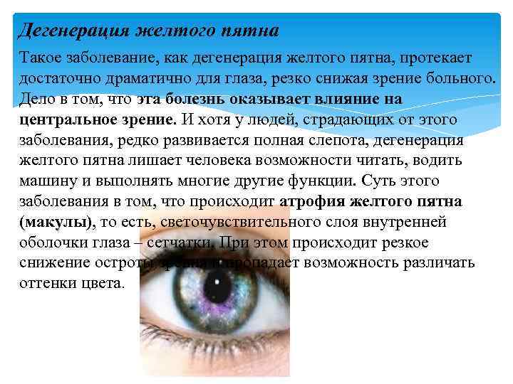 Заболевания органов зрения в пожилом и старческом возрасте презентация