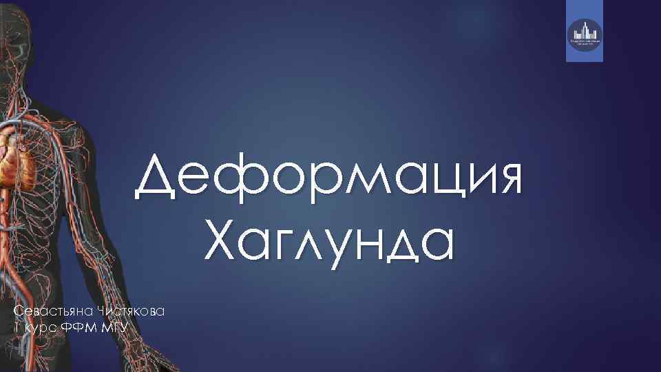 Деформация Хаглунда Севастьяна Чистякова 1 курс ФФМ МГУ 