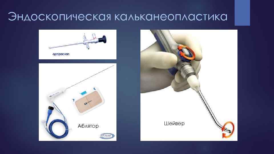 Эндоскопическая кальканеопластика Аблятор Шейвер 