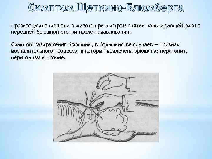 Симптом щеткина блюмберга боли в правом подреберье спереди после еды