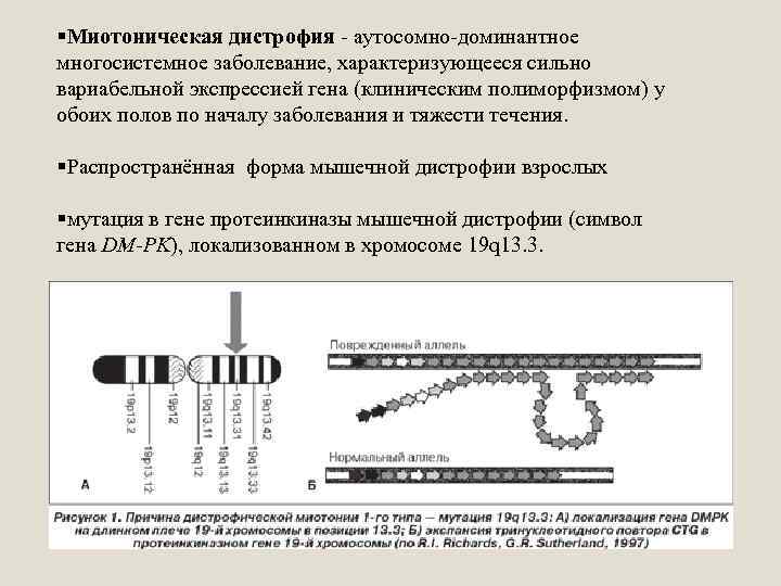 §Миотоническая дистрофия - аутосомно-доминантное многосистемное заболевание, характеризующееся сильно вариабельной экспрессией гена (клиническим полиморфизмом) у