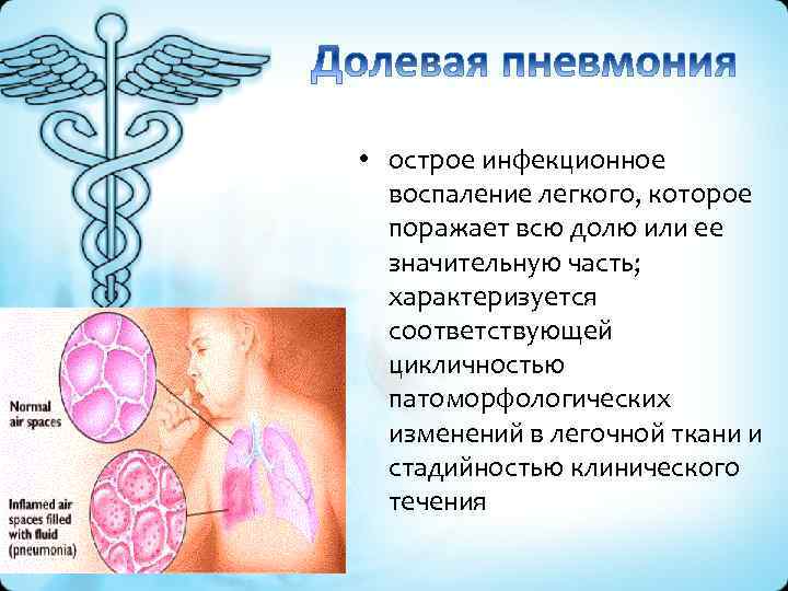  • острое инфекционное воспаление легкого, которое поражает всю долю или ее значительную часть;