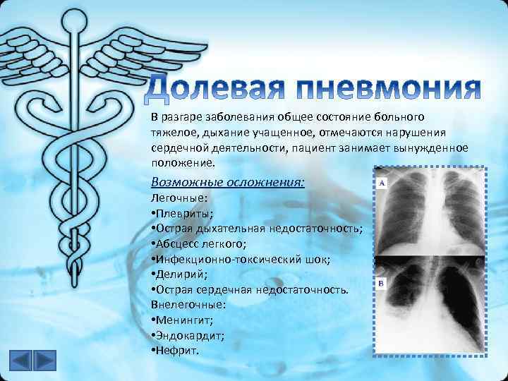 В разгаре заболевания общее состояние больного тяжелое, дыхание учащенное, отмечаются нарушения сердечной деятельности, пациент