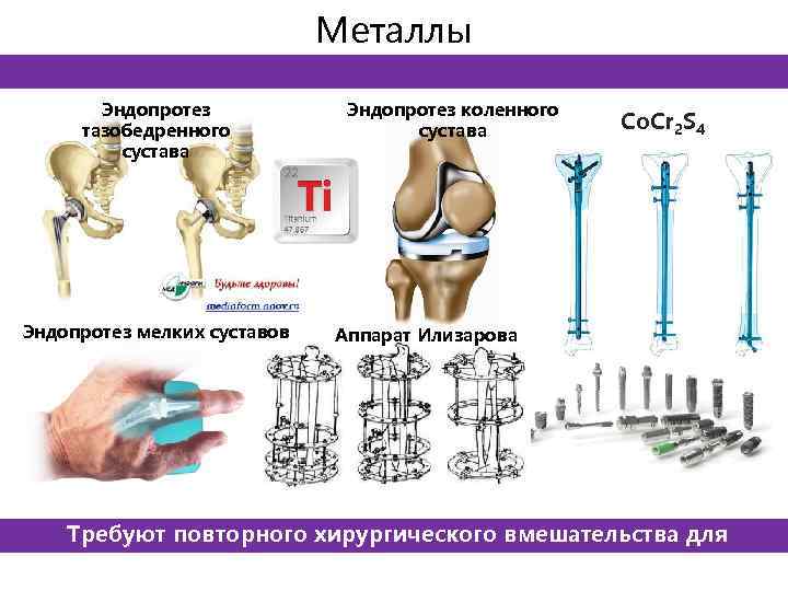 Металлы Эндопротез тазобедренного сустава Эндопротез мелких суставов Эндопротез коленного сустава Co. Cr 2 S