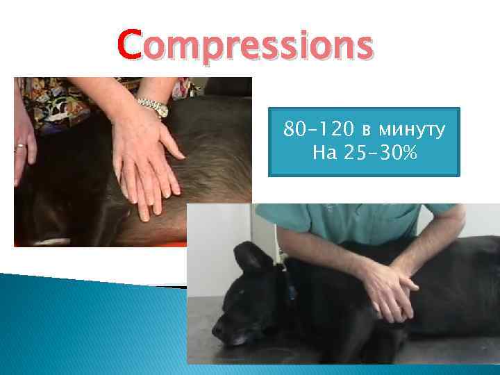 Compressions 80 -120 в минуту На 25 -30% 