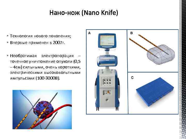 § Технология нового поколения; § Впервые применен в 2007 г. § Необратимая электропорация –