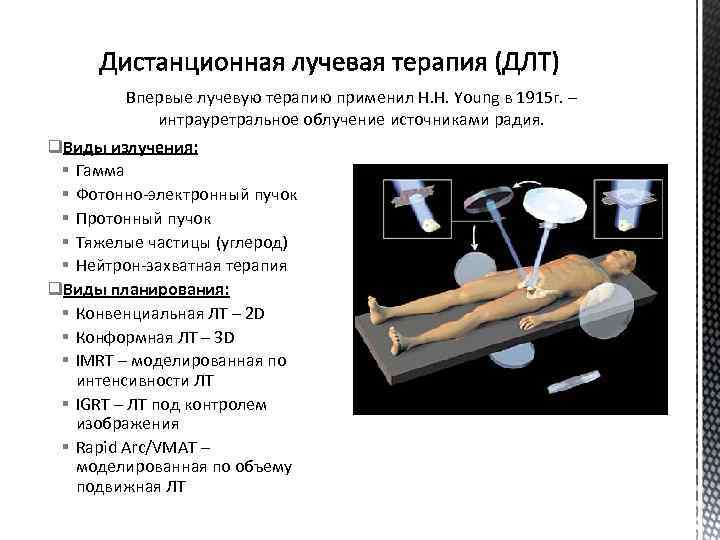 Впервые лучевую терапию применил H. H. Young в 1915 г. – интрауретральное облучение источниками