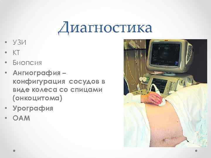 Диагностика УЗИ КТ Биопсия Ангиография – конфигурация сосудов в виде колеса со спицами (онкоцитома)