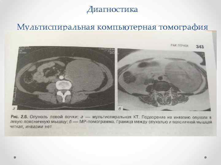 Диагностика Мультиспиральная компьютерная томография 