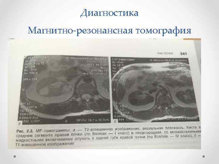 Диагностика Магнитно-резонансная томография 