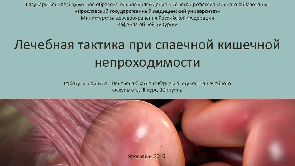 Государственное бюджетное образовательное учреждение высшего профессионального образования «Ярославский государственный медицинский университет» Министерства здравоохранения Российской