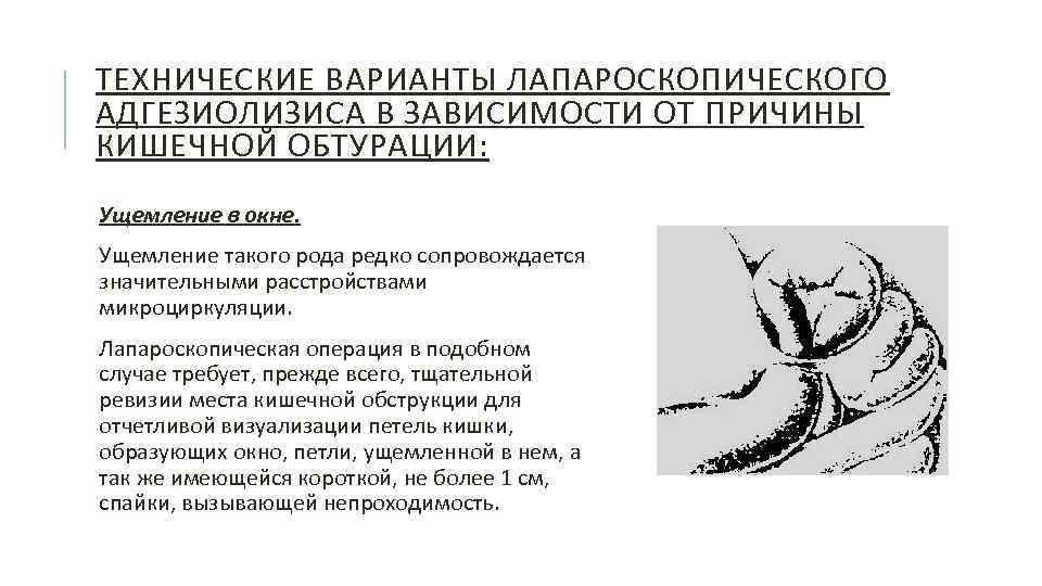 ТЕХНИЧЕСКИЕ ВАРИАНТЫ ЛАПАРОСКОПИЧЕСКОГО АДГЕЗИОЛИЗИСА В ЗАВИСИМОСТИ ОТ ПРИЧИНЫ КИШЕЧНОЙ ОБТУРАЦИИ: Ущемление в окне. Ущемление