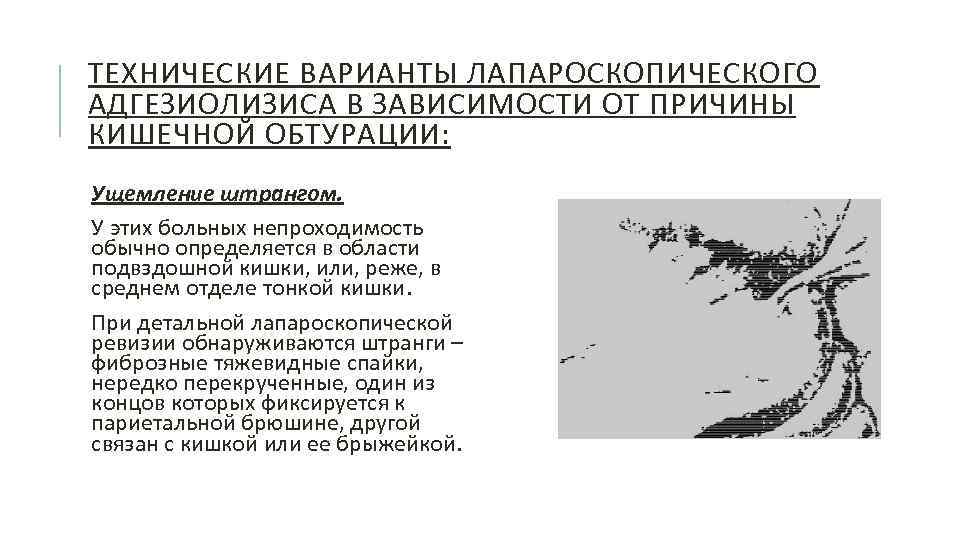 ТЕХНИЧЕСКИЕ ВАРИАНТЫ ЛАПАРОСКОПИЧЕСКОГО АДГЕЗИОЛИЗИСА В ЗАВИСИМОСТИ ОТ ПРИЧИНЫ КИШЕЧНОЙ ОБТУРАЦИИ: Ущемление штрангом. У этих