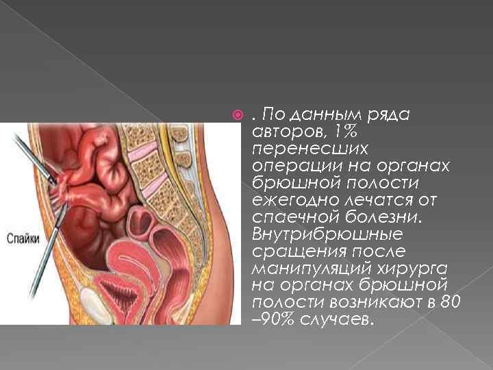  . По данным ряда авторов, 1% перенесших операции на органах брюшной полости ежегодно