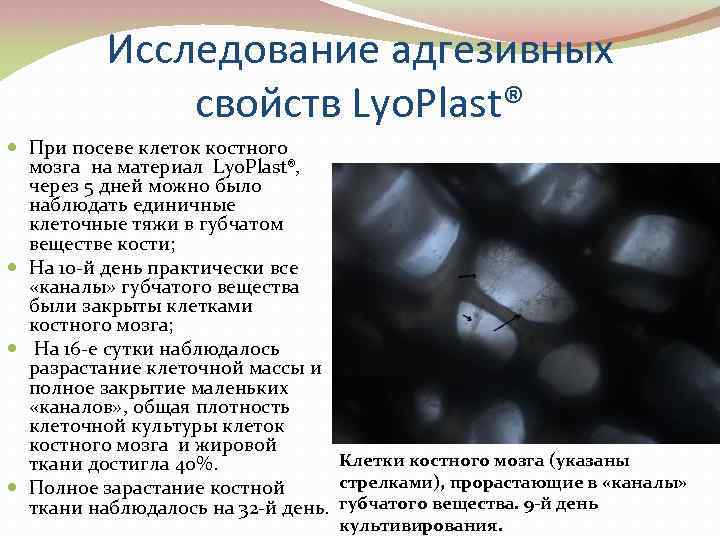 Исследование адгезивных свойств Lyo. Plast® При посеве клеток костного мозга на материал Lyo. Plast®,