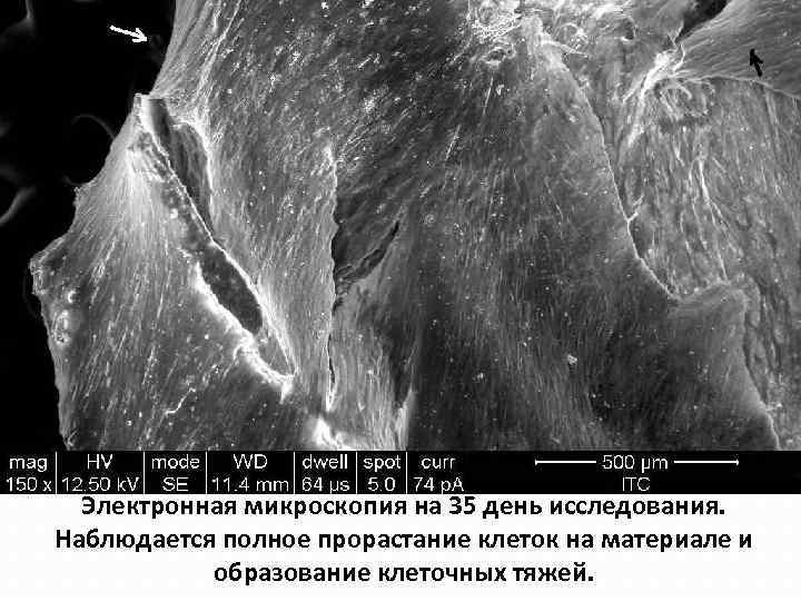 Электронная микроскопия на 35 день исследования. Наблюдается полное прорастание клеток на материале и образование
