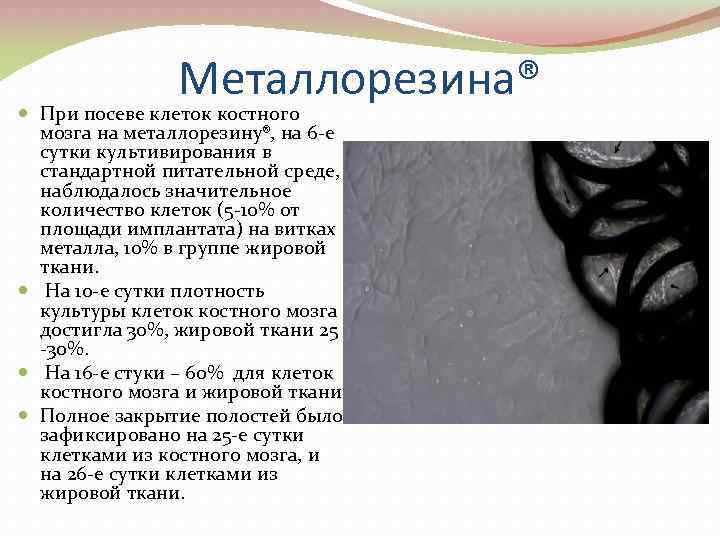 Металлорезина® При посеве клеток костного мозга на металлорезину®, на 6 -е сутки культивирования в