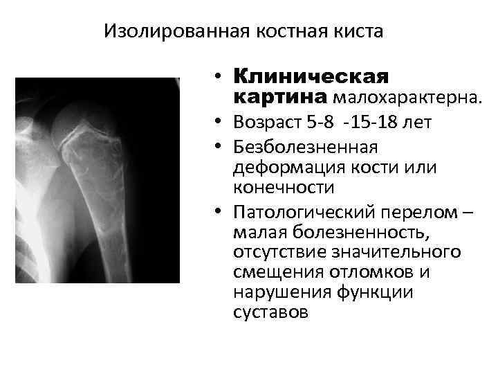 Для рентгенологической картины фолликулярной кисты характерна деструкция костной ткани в виде