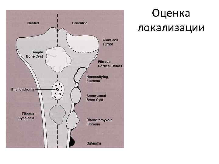 Оценка локализации 