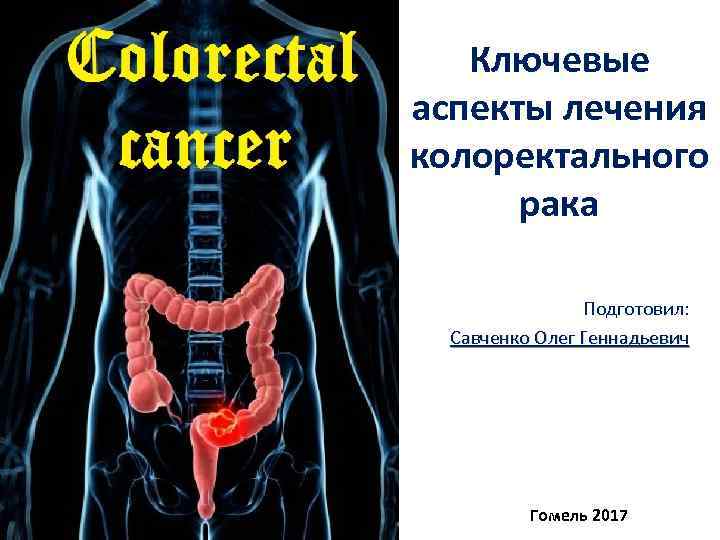 Ключевые аспекты лечения колоректального рака Подготовил: Савченко Олег Геннадьевич Гомель 2017 