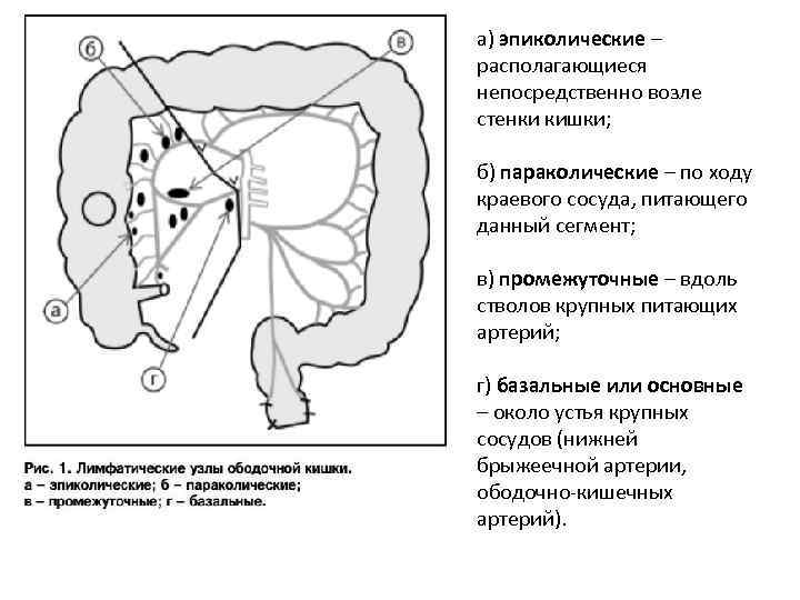 а) эпиколические – располагающиеся непосредственно возле стенки кишки; б) параколические – по ходу краевого