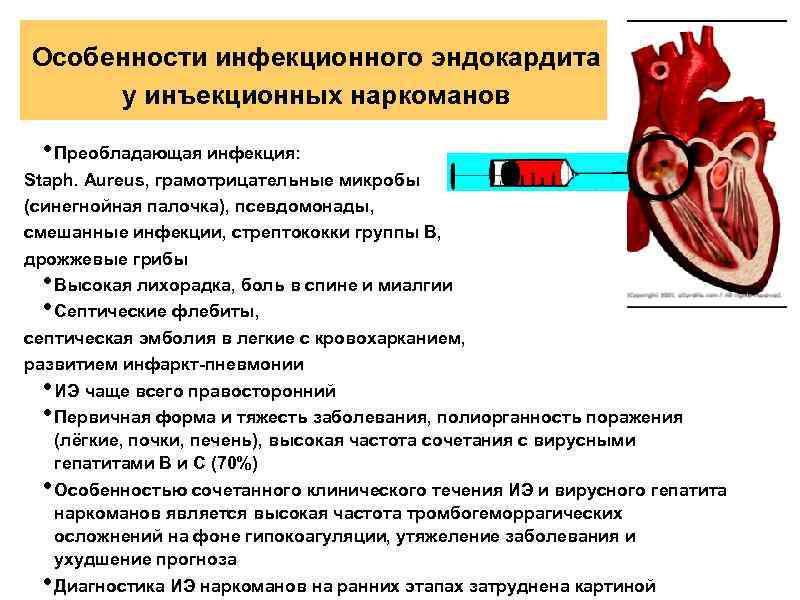 Инфекционный эндокардит терапия презентация