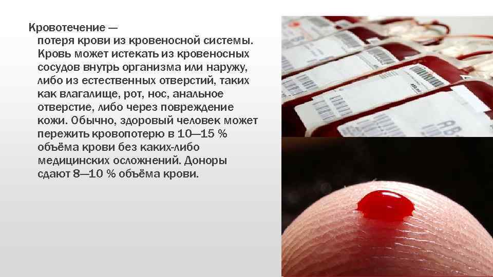 Кровотечение — потеря крови из кровеносной системы. Кровь может истекать из кровеносных сосудов внутрь