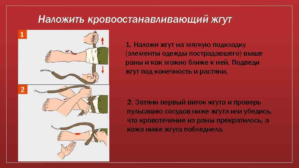 Наложить кровоостанавливающий жгут 1. Наложи жгут на мягкую подкладку (элементы одежды пострадавшего) выше раны