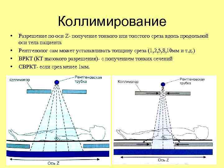 Коллимирование • • Разрешение по оси Z- получение тонкого или толстого среза вдоль продольной