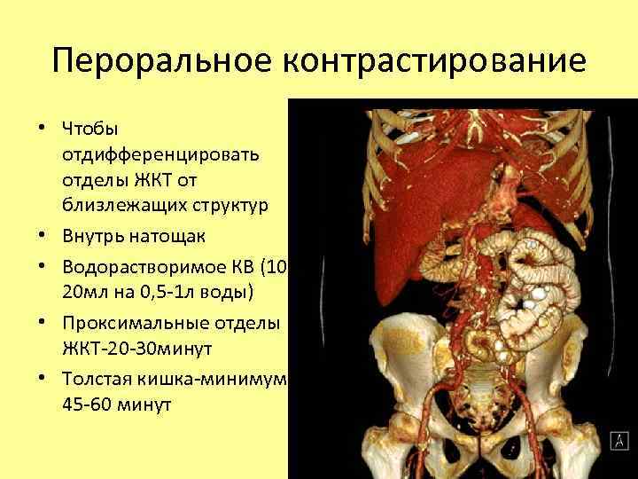 Пероральное контрастирование • Чтобы отдифференцировать отделы ЖКТ от близлежащих структур • Внутрь натощак •