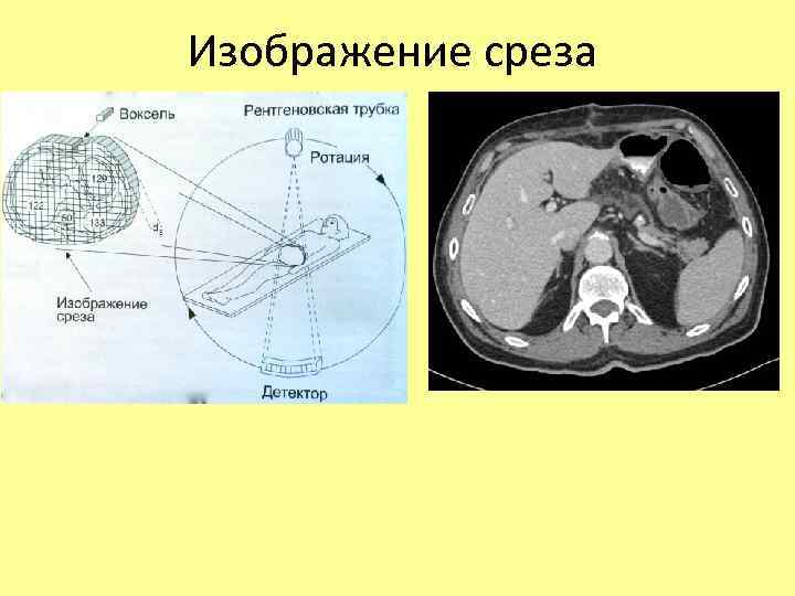 Изображение среза 