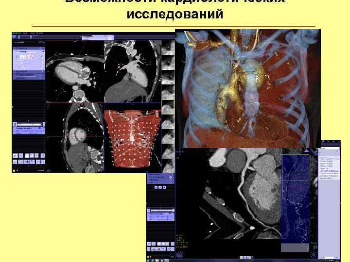 Возможности кардиологических исследований 