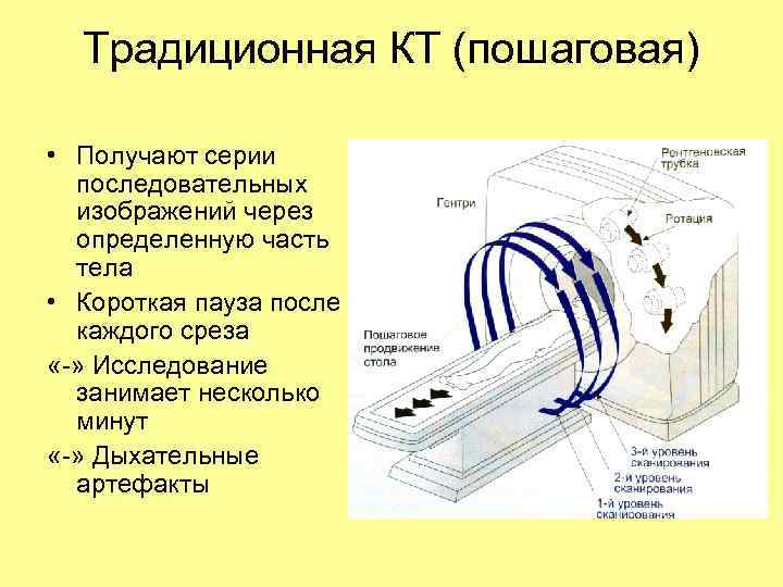 Традиционная КТ (пошаговая) • Получают серии последовательных изображений через определенную часть тела • Короткая