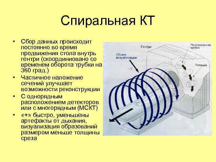 Спиральная КТ • Сбор данных происходит постоянно во время продвижения стола внутрь гентри (скоординиовано