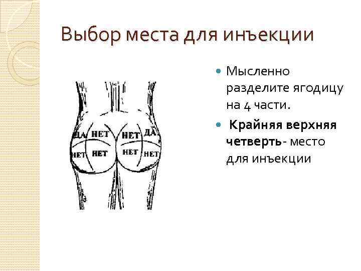 Внутримышечная инъекция в ягодицу. Как делать укол в ягодицу взрослому правильно. Разделение попы для уколов. Как правильно разделить ягодицу для укола на 4 части.