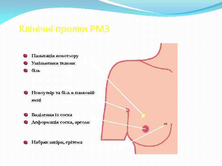 Клінічні прояви РМЗ Пальпація новотвору Ущільнення тканин біль Новоутвір та біль в пахвовій ямці