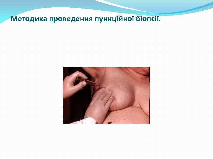 Методика проведення пункційної біопсії. 