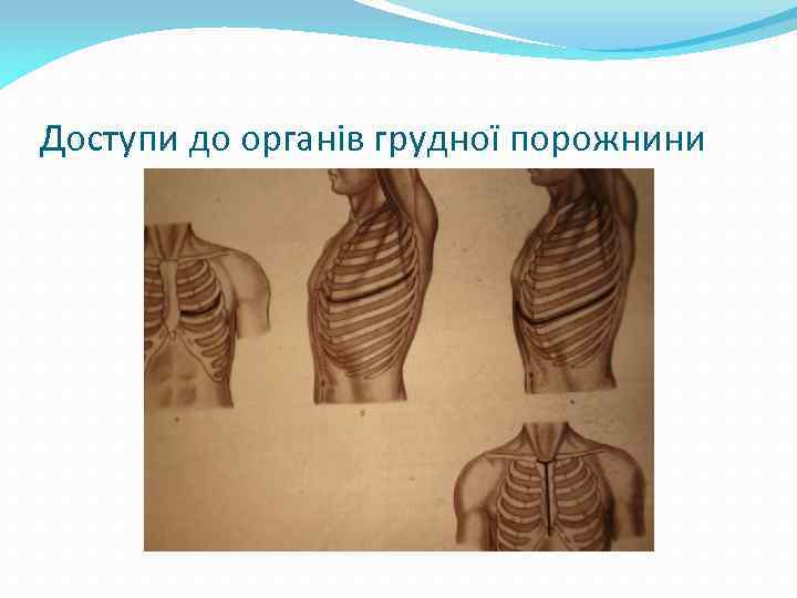 Доступи до органів грудної порожнини 