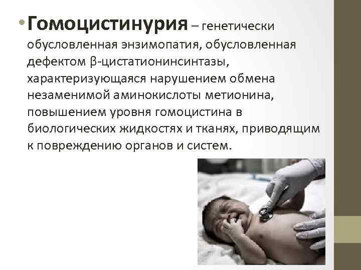  • Гомоцистинурия – генетически обусловленная энзимопатия, обусловленная дефектом β-цистатионинсинтазы, характеризующаяся нарушением обмена незаменимой