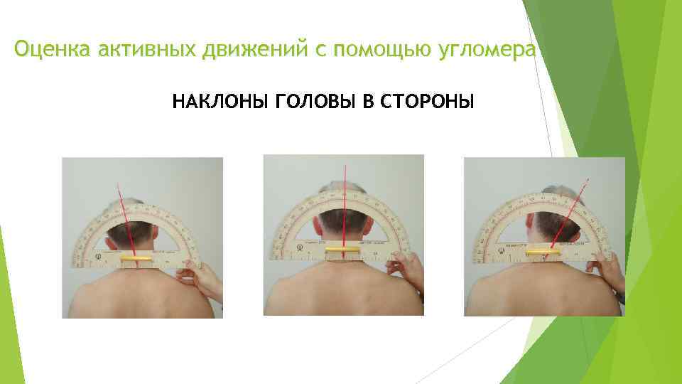 Оценка активных движений с помощью угломера НАКЛОНЫ ГОЛОВЫ В СТОРОНЫ 
