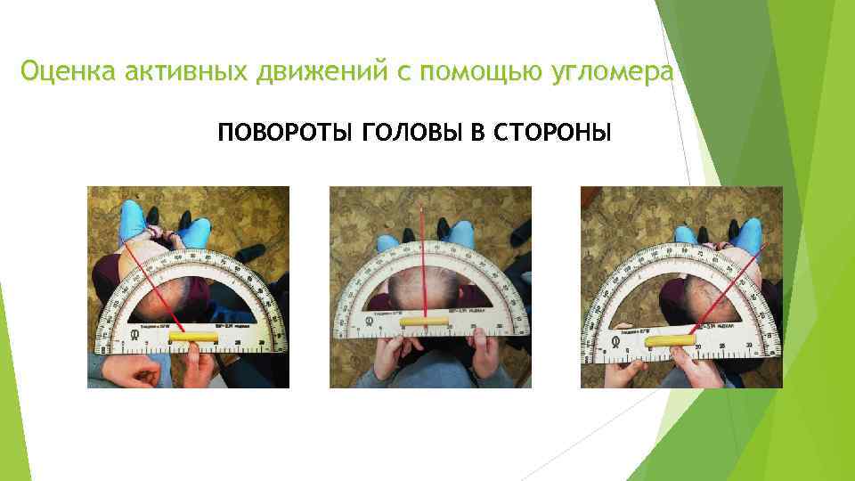 Оценка активных движений с помощью угломера ПОВОРОТЫ ГОЛОВЫ В СТОРОНЫ 