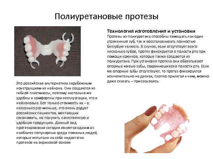 Полиуретановые протезы Технология изготовления и установки Это российская альтернатива зарубежным конструкциям из нейлона. Они