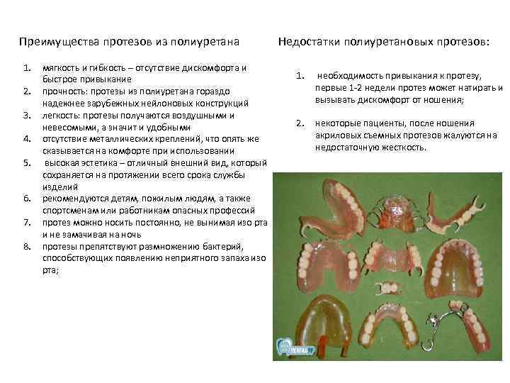 Преимущества протезов из полиуретана 1. 2. 3. 4. 5. 6. 7. 8. мягкость и