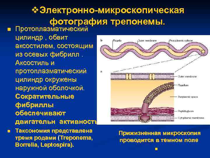 v. Электронно-микроскопическая фотография трепонемы. n Протоплазматический цилиндр , обвит аксостилем, состоящим из осевых фибрилл.