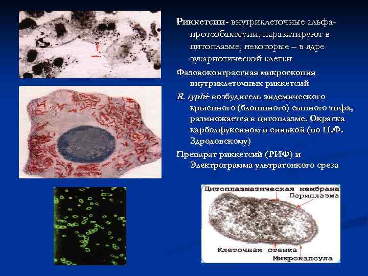 Токсины риккетсий. Рикеетсии провчека микроскопия. Риккетсии Электронограмма. Строение риккетсий микробиология. Rickettsia prowazekii морфология.