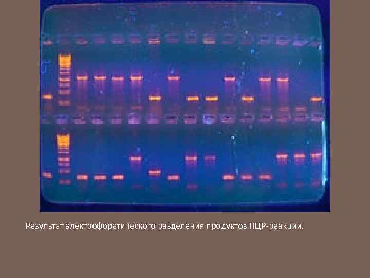 Результат электрофоретического разделения продуктов ПЦР-реакции. 
