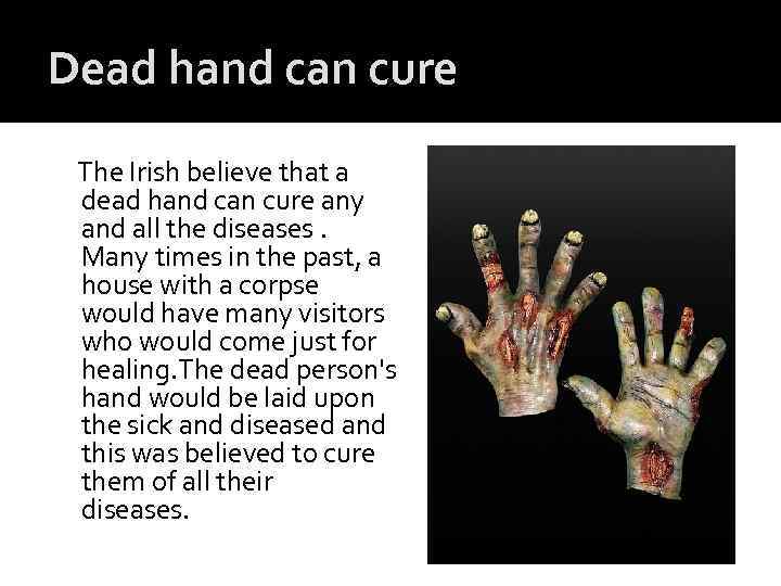 Dead hand can cure The Irish believe that a dead hand can cure any