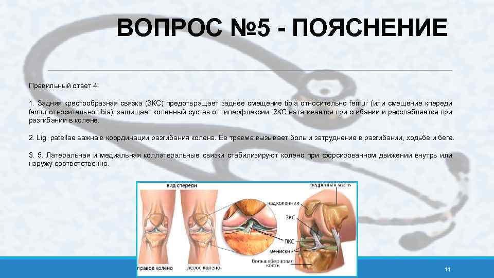 ВОПРОС № 5 - ПОЯСНЕНИЕ Правильный ответ 4. 1. Задняя крестообразная связка (ЗКС) предотвращает